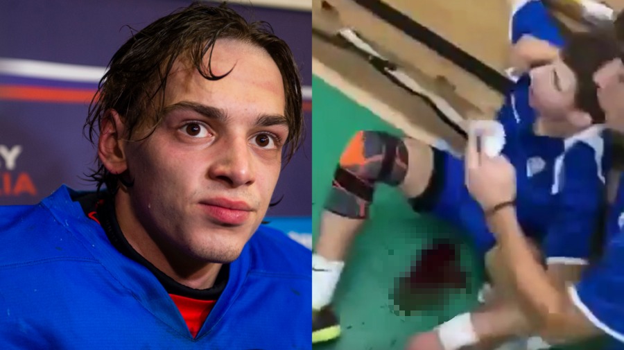 Žiak gymnázia krváca po bitke na florbalovom turnaji