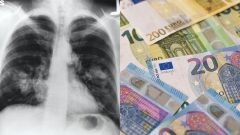 Alarmujúca štúdia: Rakovina