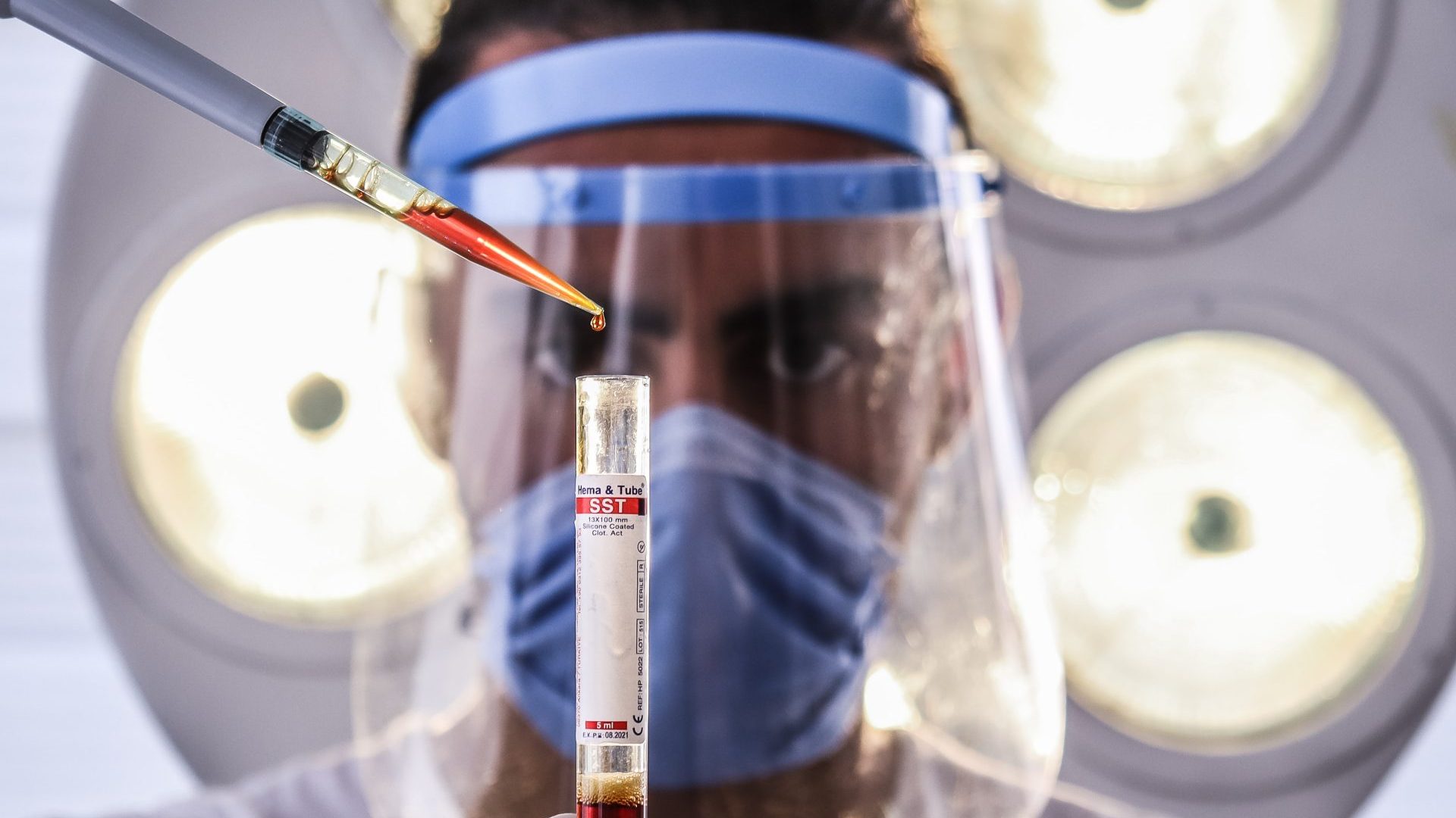 Vďaka testu si dokážu lekári potvrdiť vyslovenú diagnózu