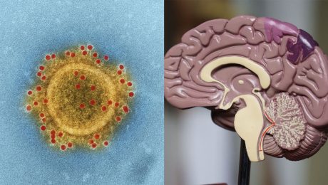 Prevratný vedecký objav: