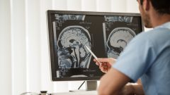 mozog rezerva lekár zdravie nemocnica