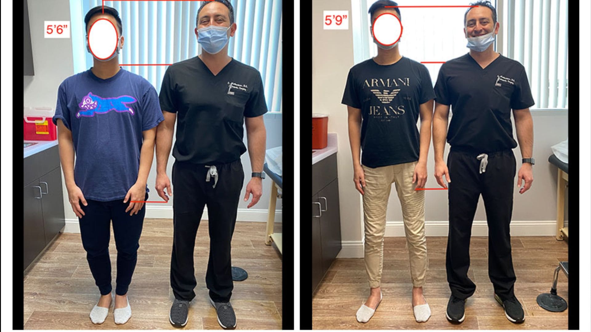 operácia zmena výšky