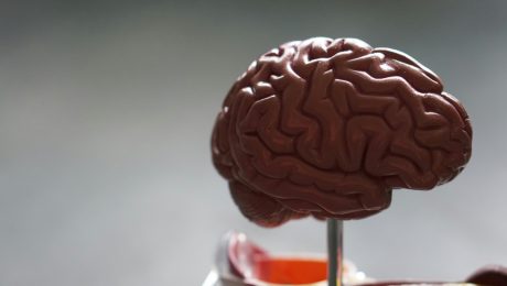 Prelomový objav v medicíne: Test odhalí Alzheimera 15 rokov pred prvými príznakmi