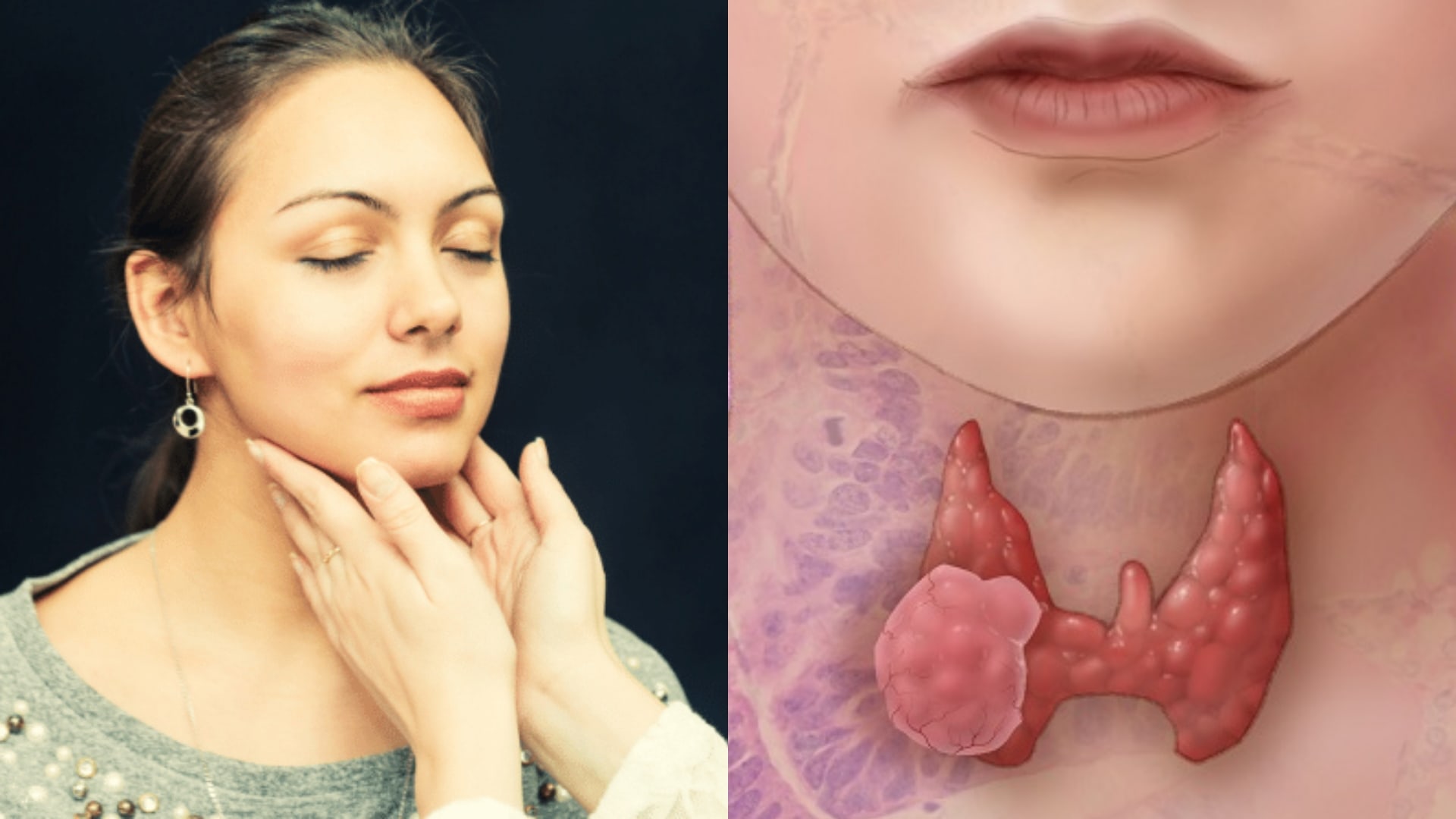 ochorenia štítnej žľazy