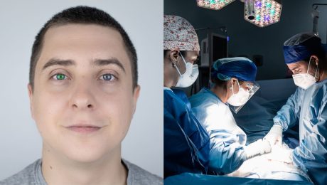 farba očí operácia zákrok