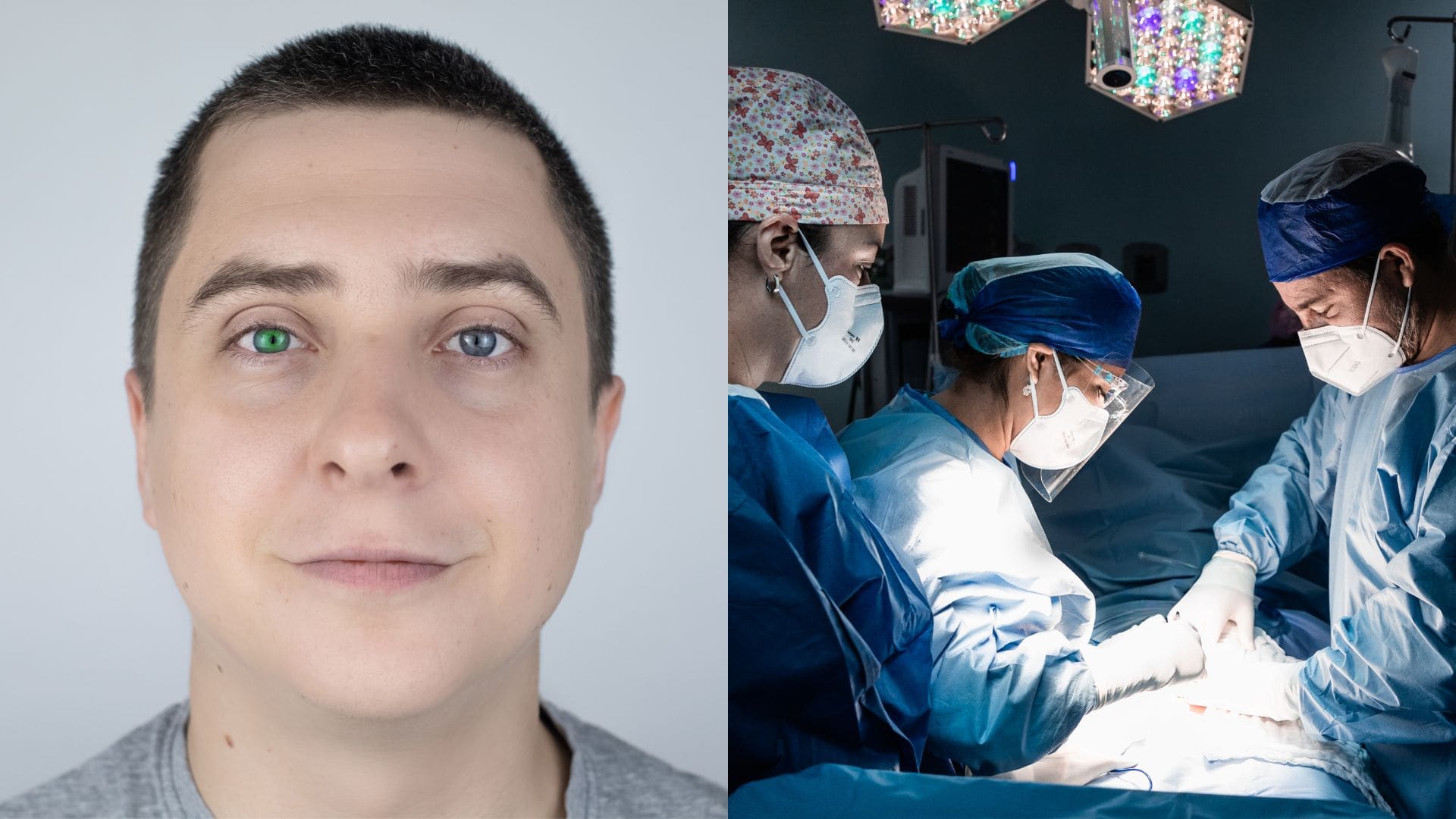 farba očí operácia zákrok