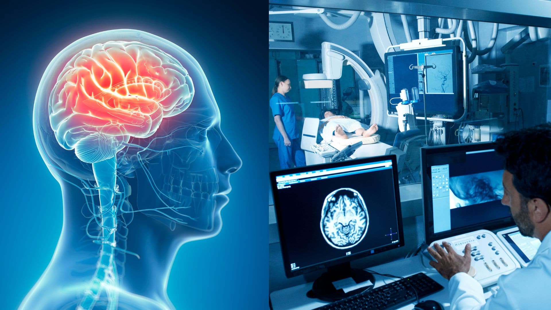 mozog, mri