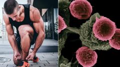 27-tisíc nádorov ročne: Slovenskí muži prichádzajú k lekárovi neskoro, prevencia zlyháva