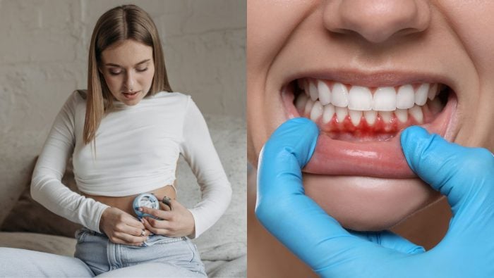 cukrovka, zuby, choroba