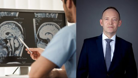 Na liečbu ochorení ide 80 % financií.