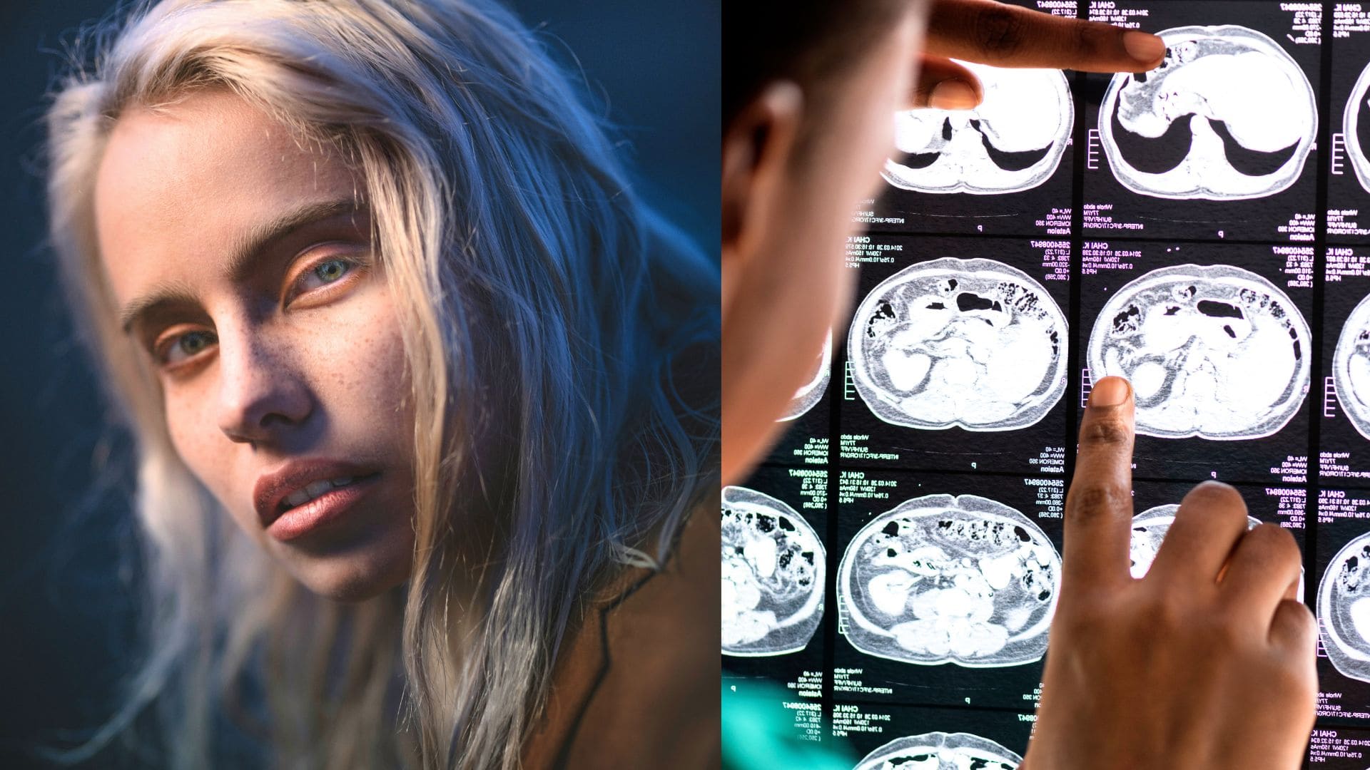 žena, portrét, scan mozgu, mozog