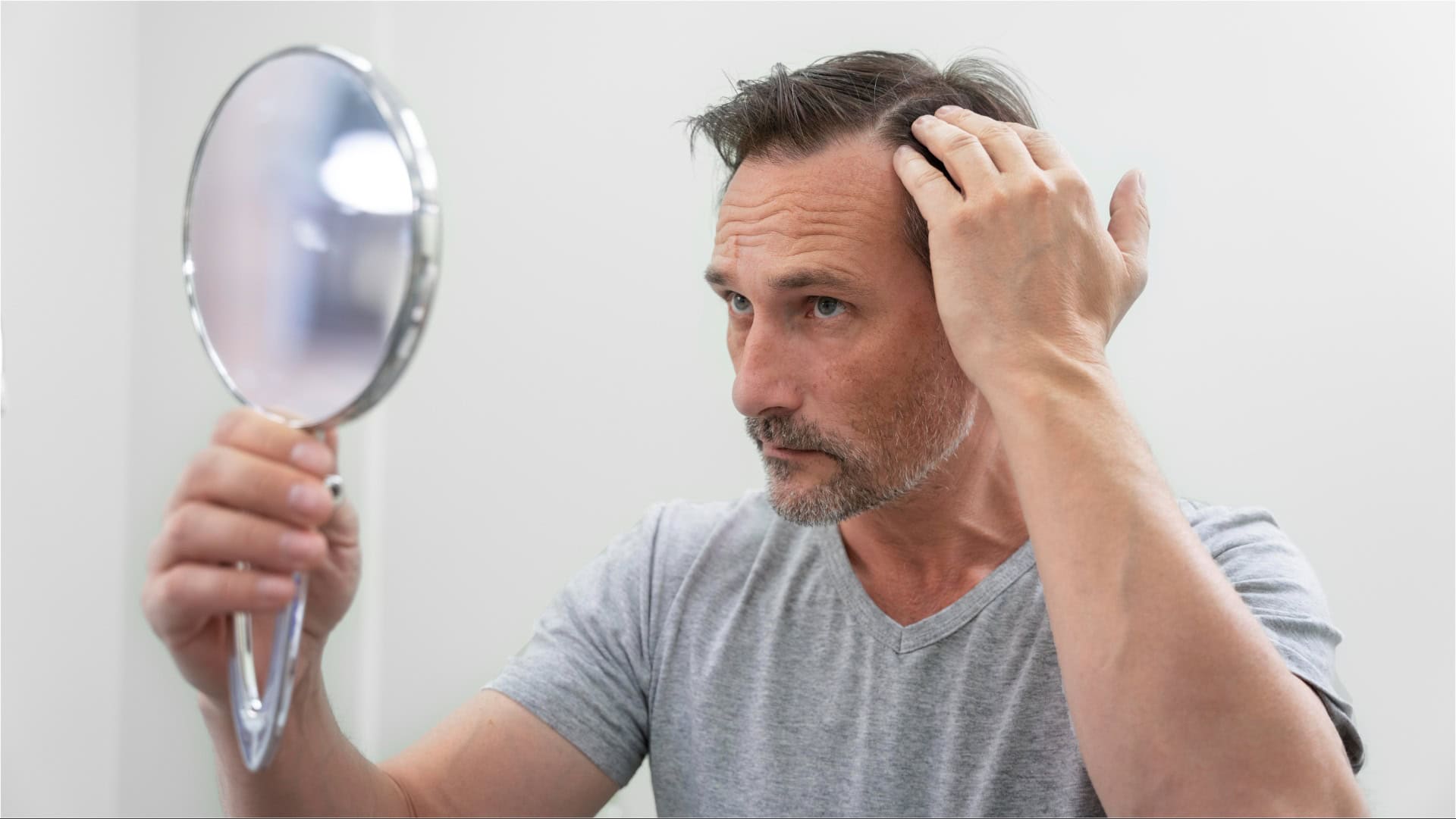 mužovi padajú vlasy
