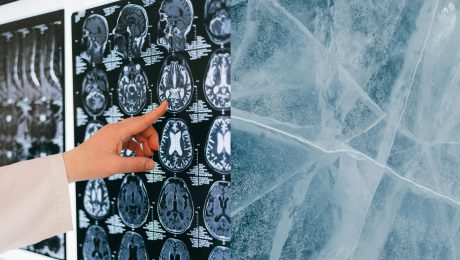 na snimke je kryonika, mozog