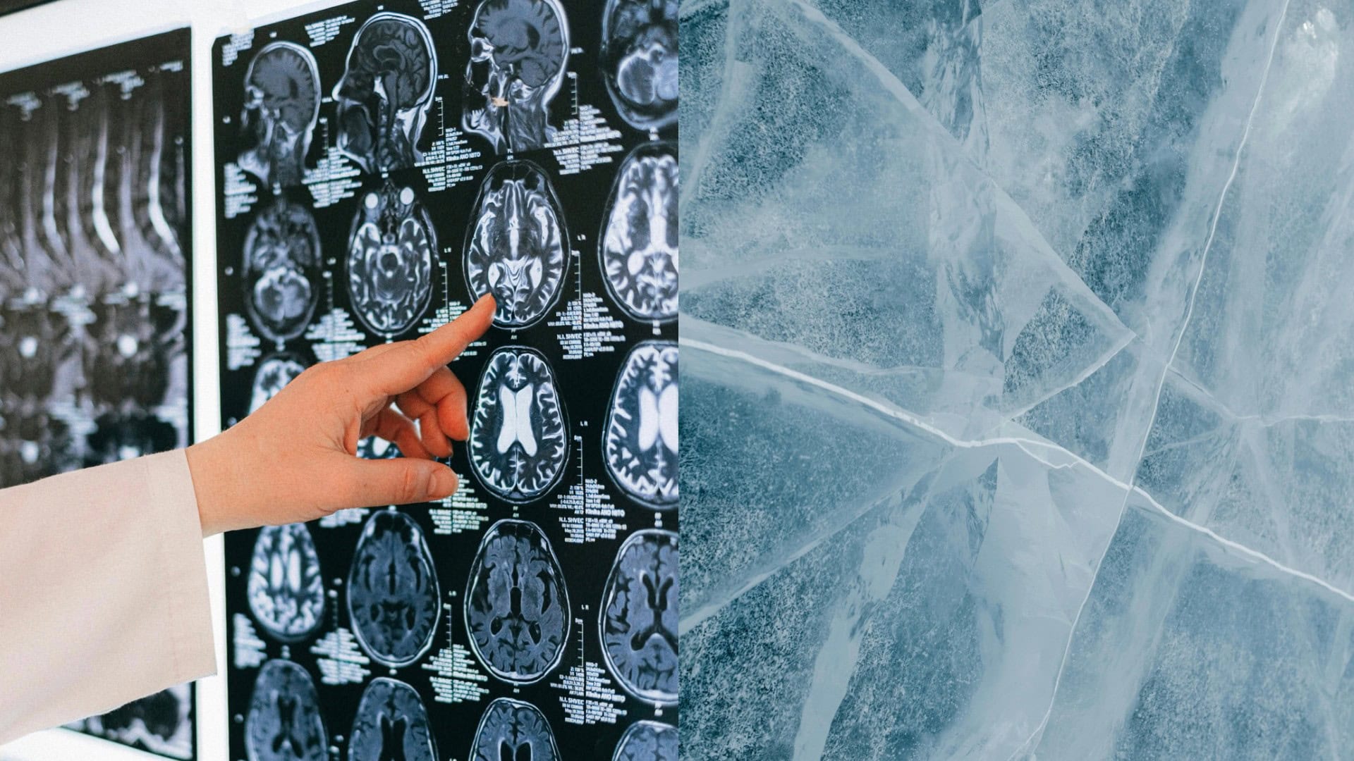 na snimke je kryonika, mozog