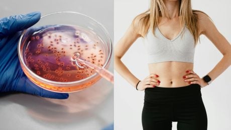 na snimke su crevne bakterie a brucho