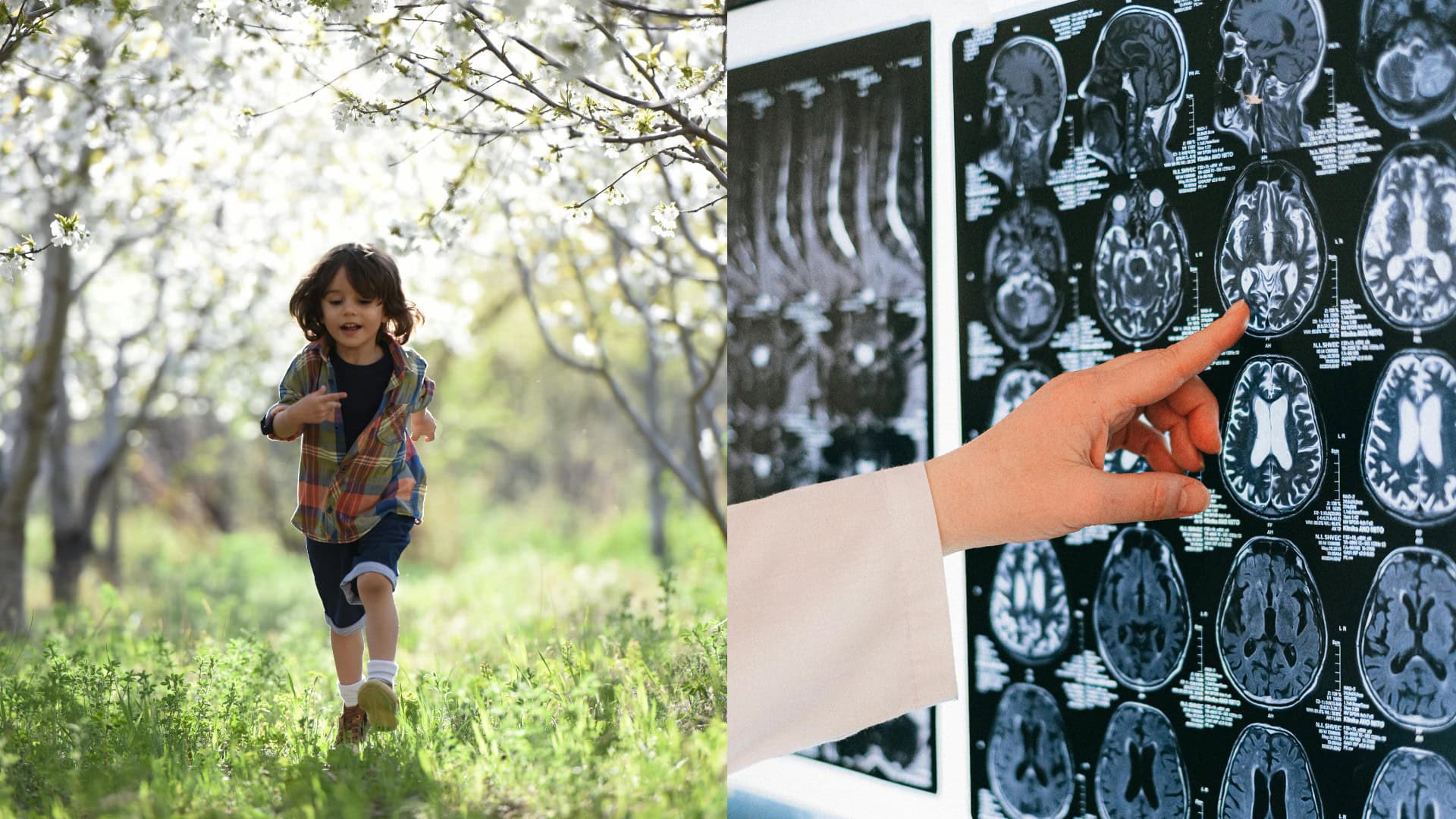 na snimke je detstvo, demencia, mozog