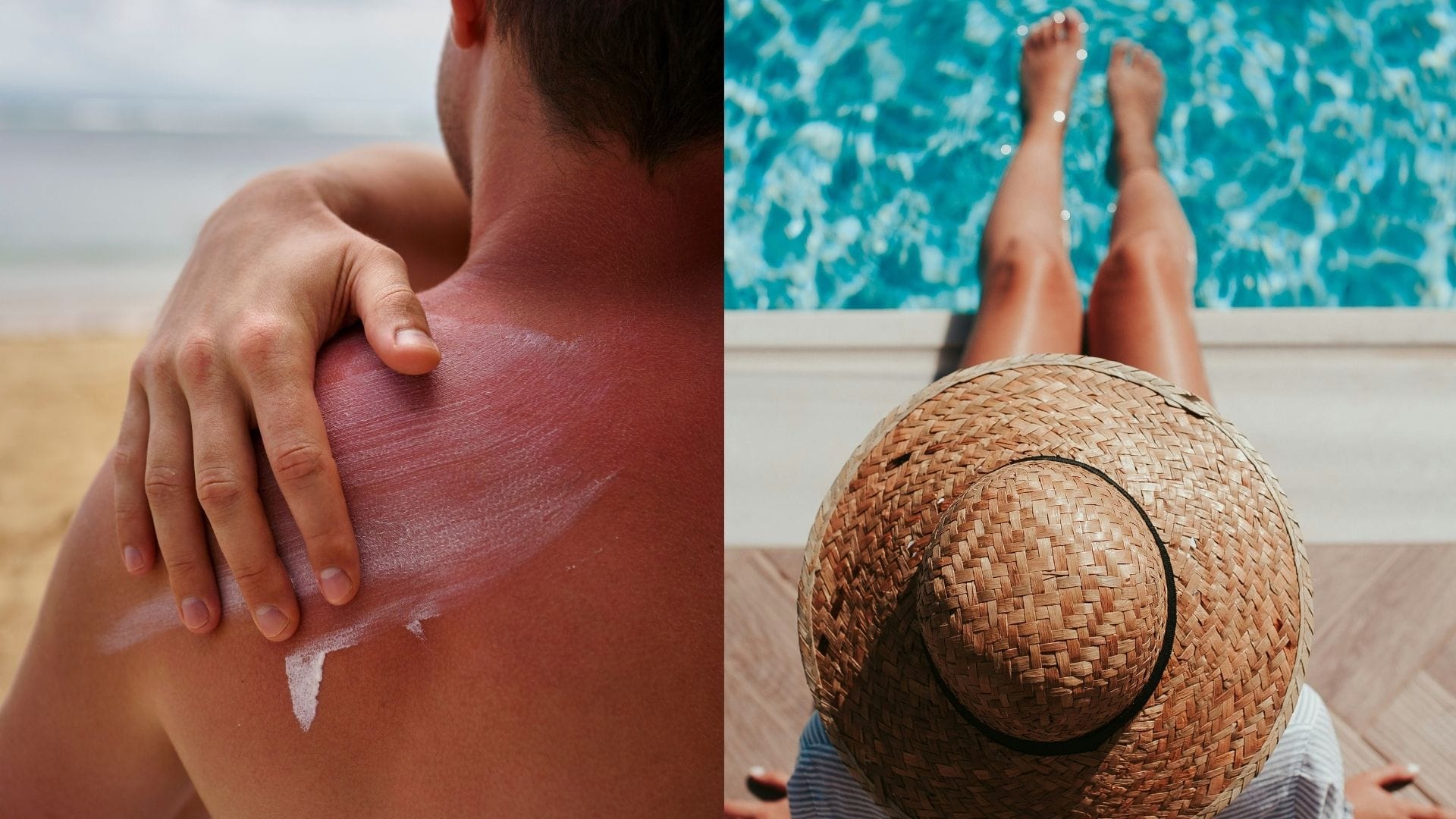 čo robiť pri spálení