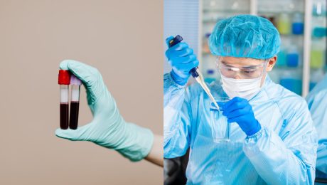 Transfúzia bez obáv