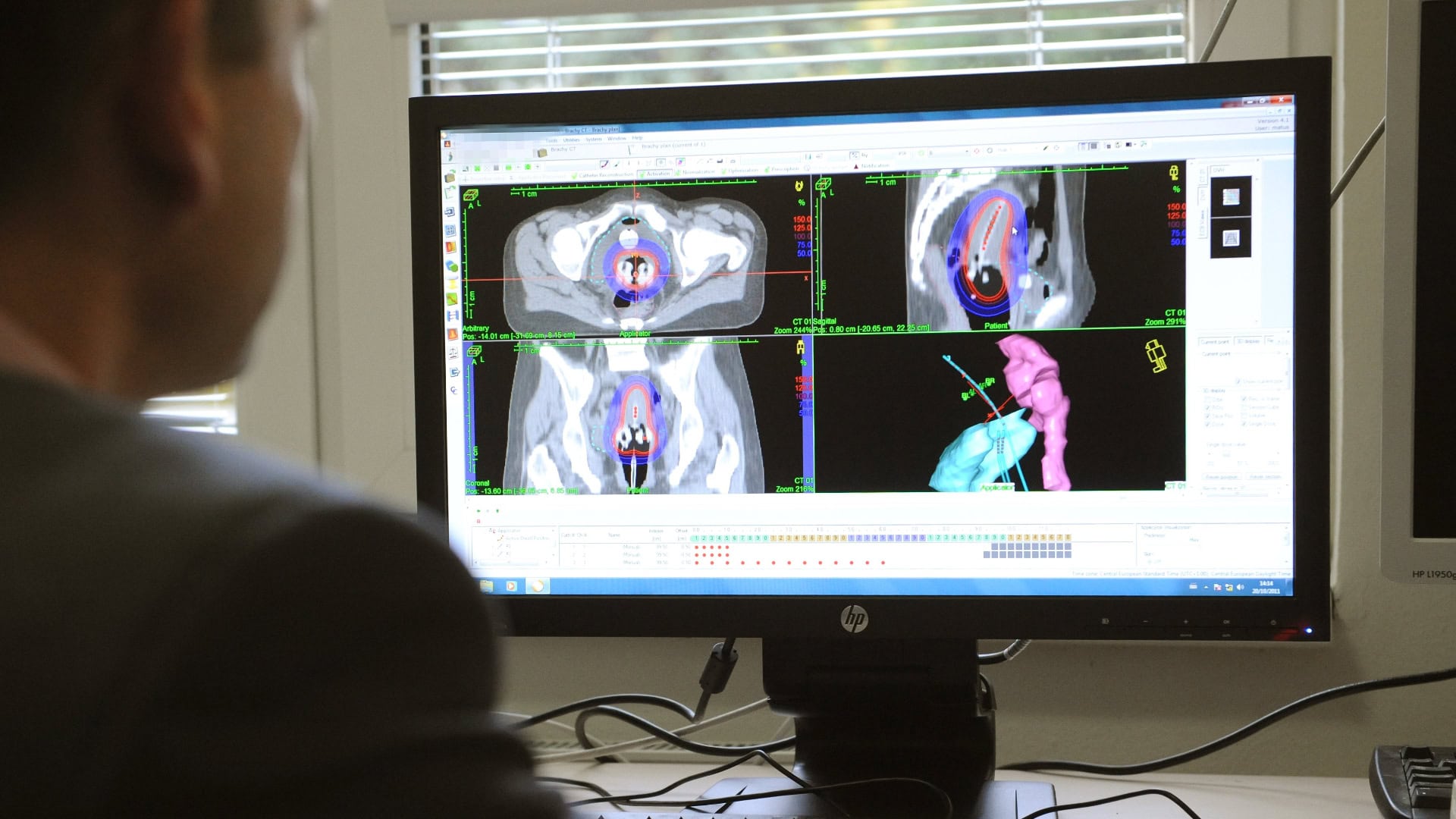 Východoslovenský onkologický ústav