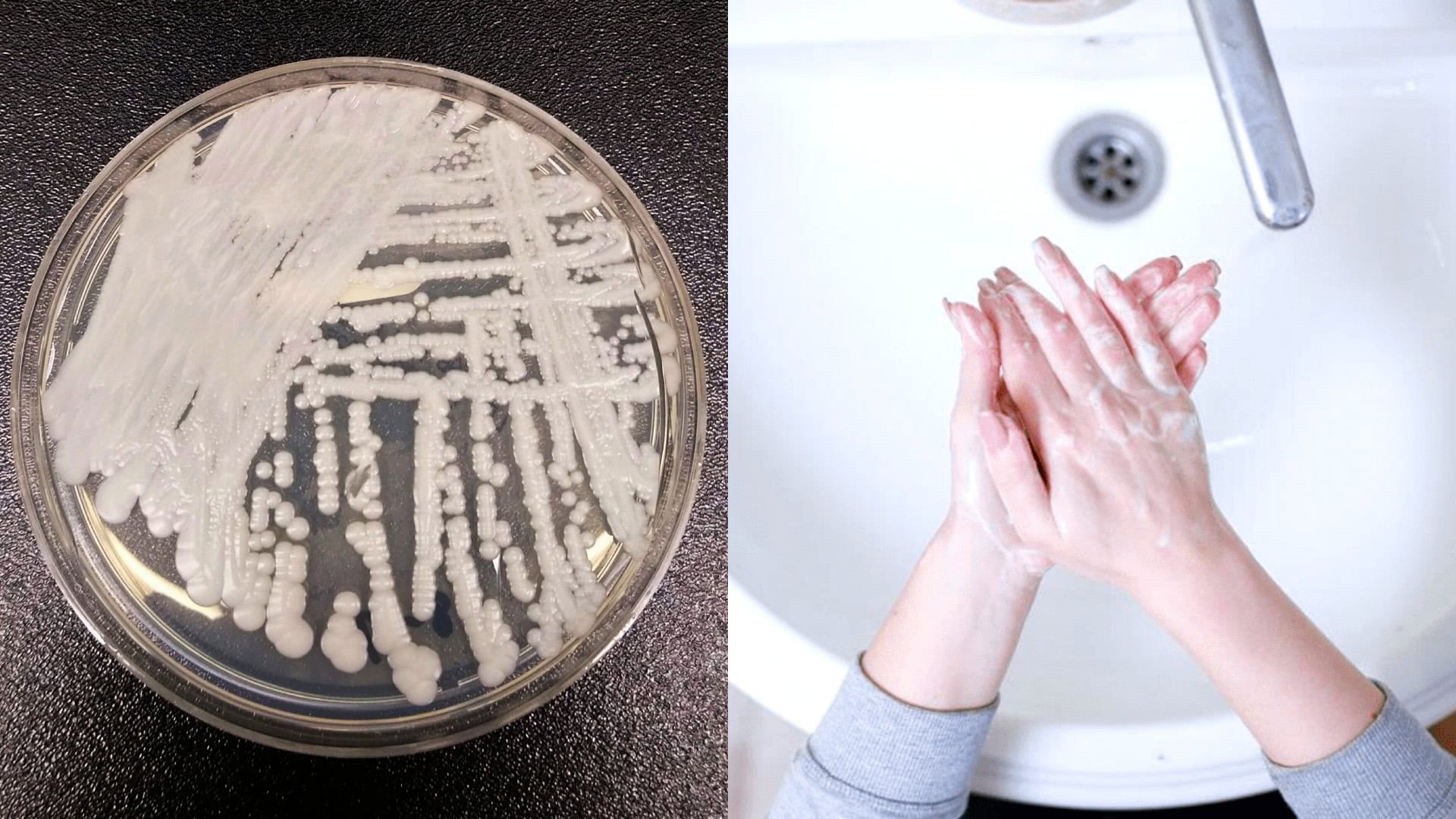 Candida auris, umývanie rúk