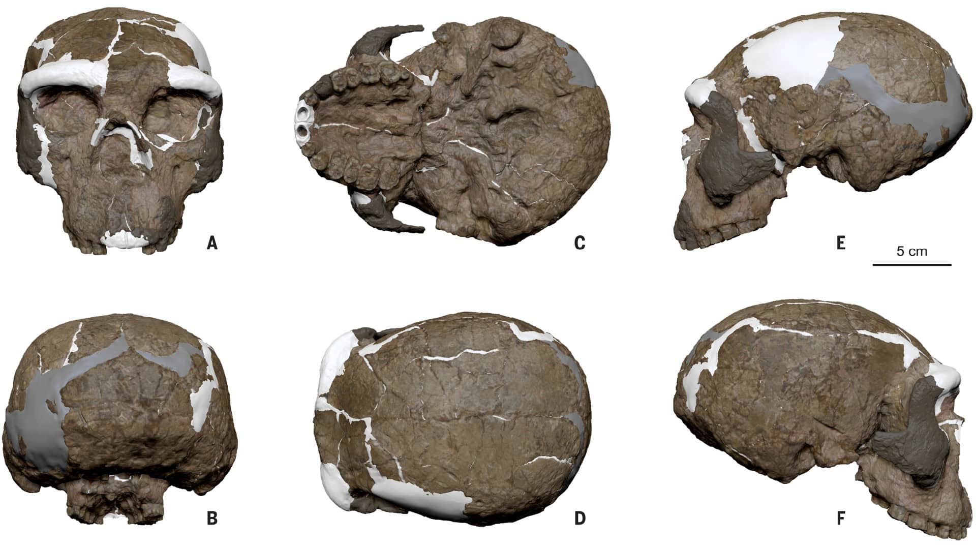 rekonštrukcia lebky