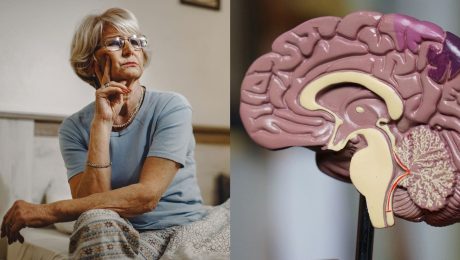 Demencia sa nezačína v hlave, ale doma: Prostredie ovplyvňuje zdravie mozgu, odhalili vedci