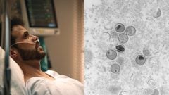 Odborníci bijú na poplach: Do Európy sa vrátila nebezpečná choroba, špecifická komunita ľudí je ohrozená najviac