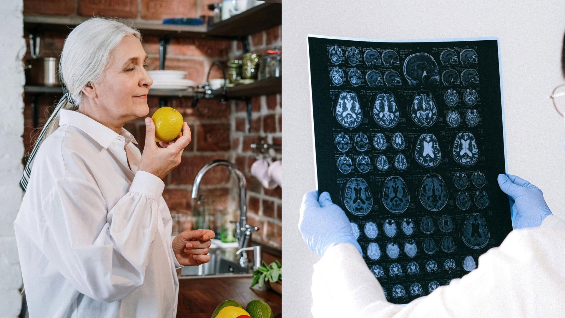 Jednoduchý test dokáže Parkinsonovu chorobu diagnostikovať roky skôr pred jej vypuknutím, zistili vedci