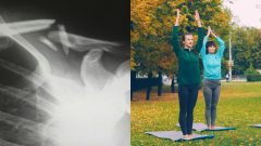 Kosti, osteoporóza, ženy, jóga, cvičenie