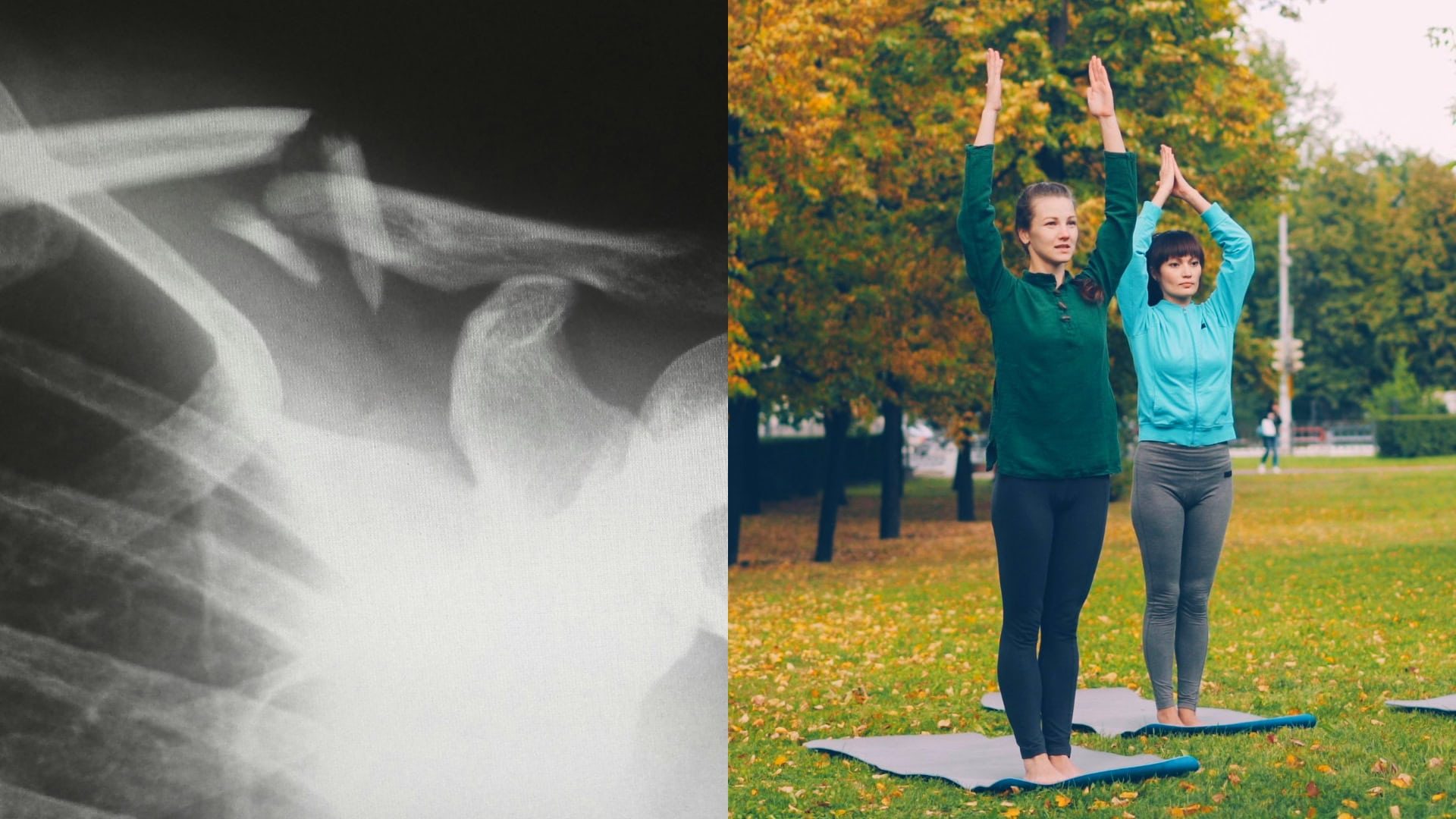 Kosti, osteoporóza, ženy, jóga, cvičenie