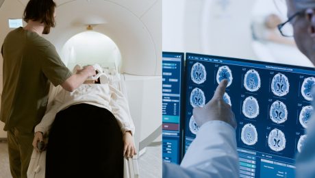 Nenápadné príznaky skrývajú