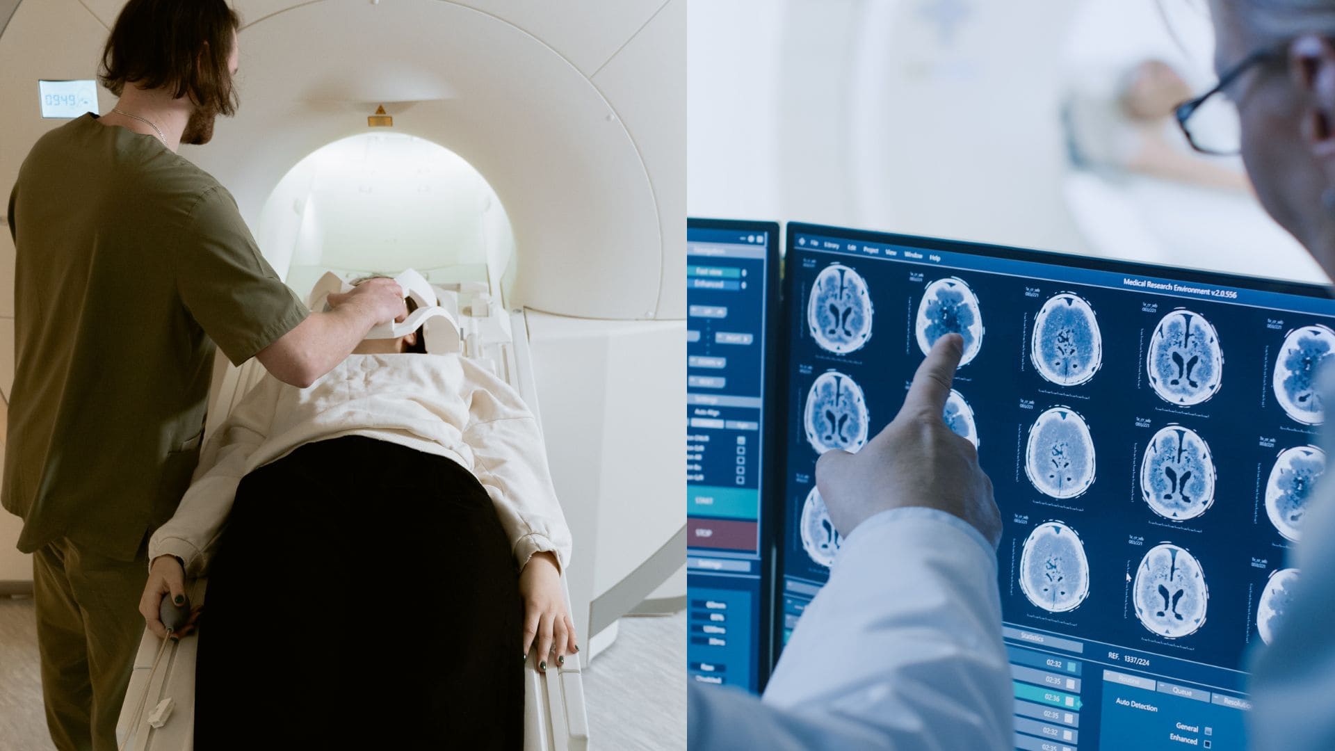 Skleróza multipex postihuje mladé ženy