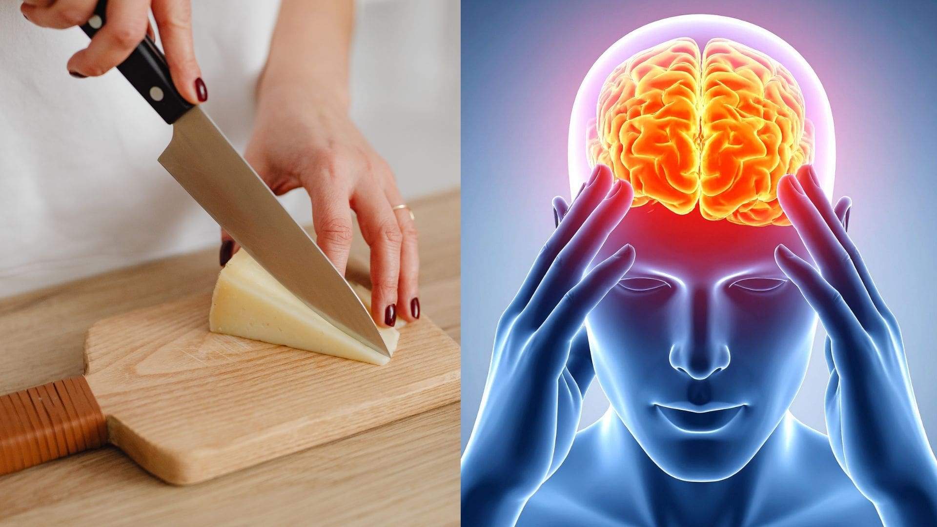 Vedci odhalili, že pravidelná konzumácia syra môže znížiť riziko demencie