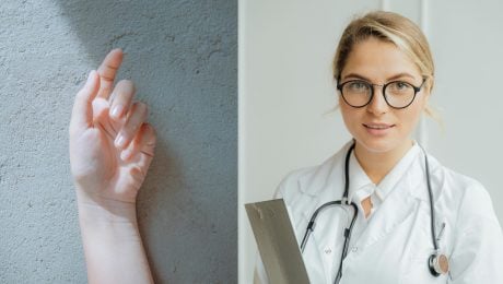 na snimke je ruka tepna