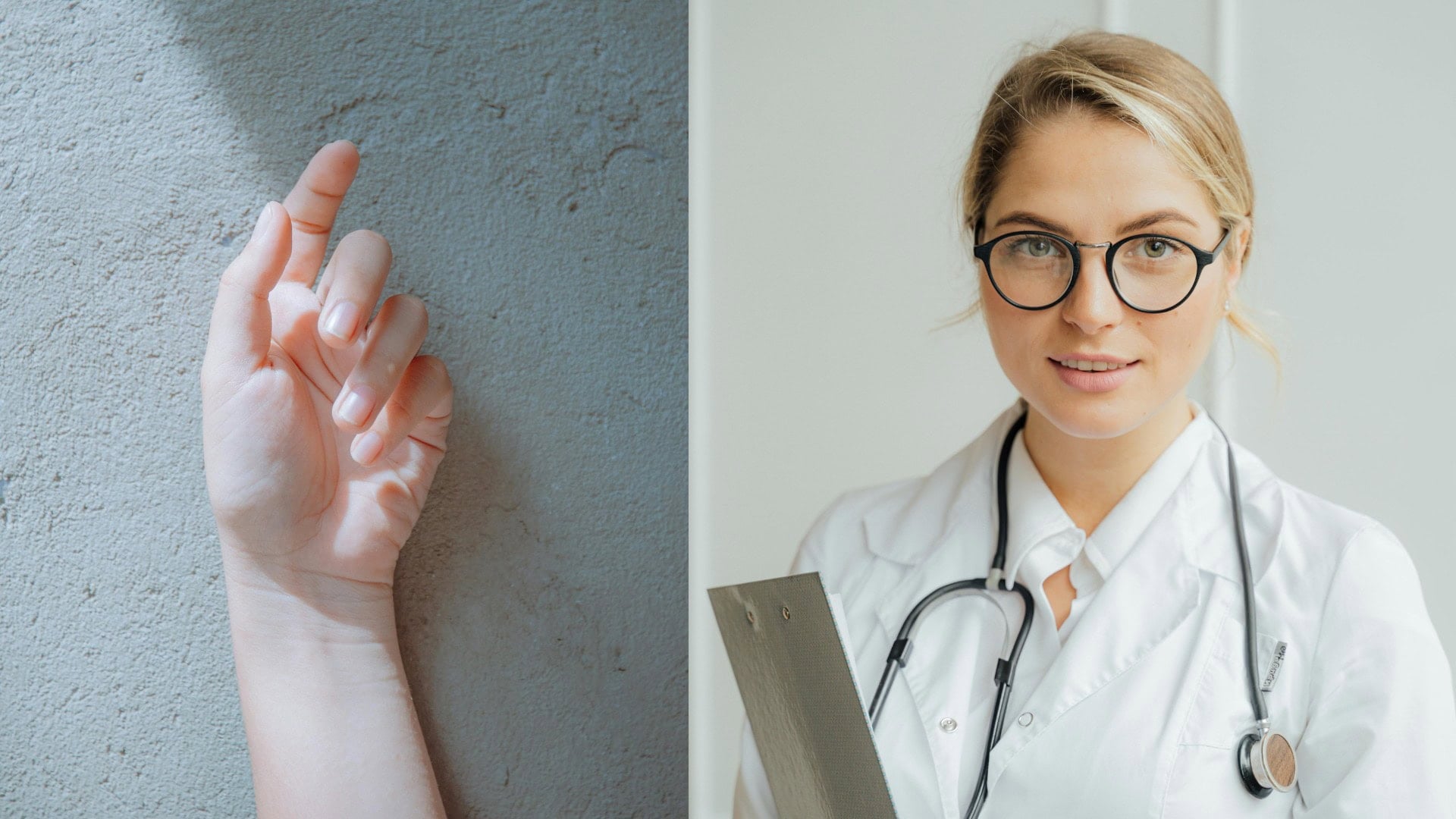 Evolúcia v priamom prenose: Tretina ľudí už má v ruke niečo navyše. Anatomická rarita sa stáva bežnou