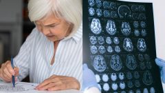 Nedostatok bežného vitamínu zvyšuje riziko demencie. Vedci varujú pred skrytou hrozbou pre mozog