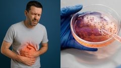 bolesti žalúdka, baktérie