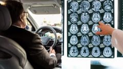 Šoférovanie odhalí skryté zmeny v mozgu. Vedci hlásia prelom, GPS je nový „digitálny biomarker“