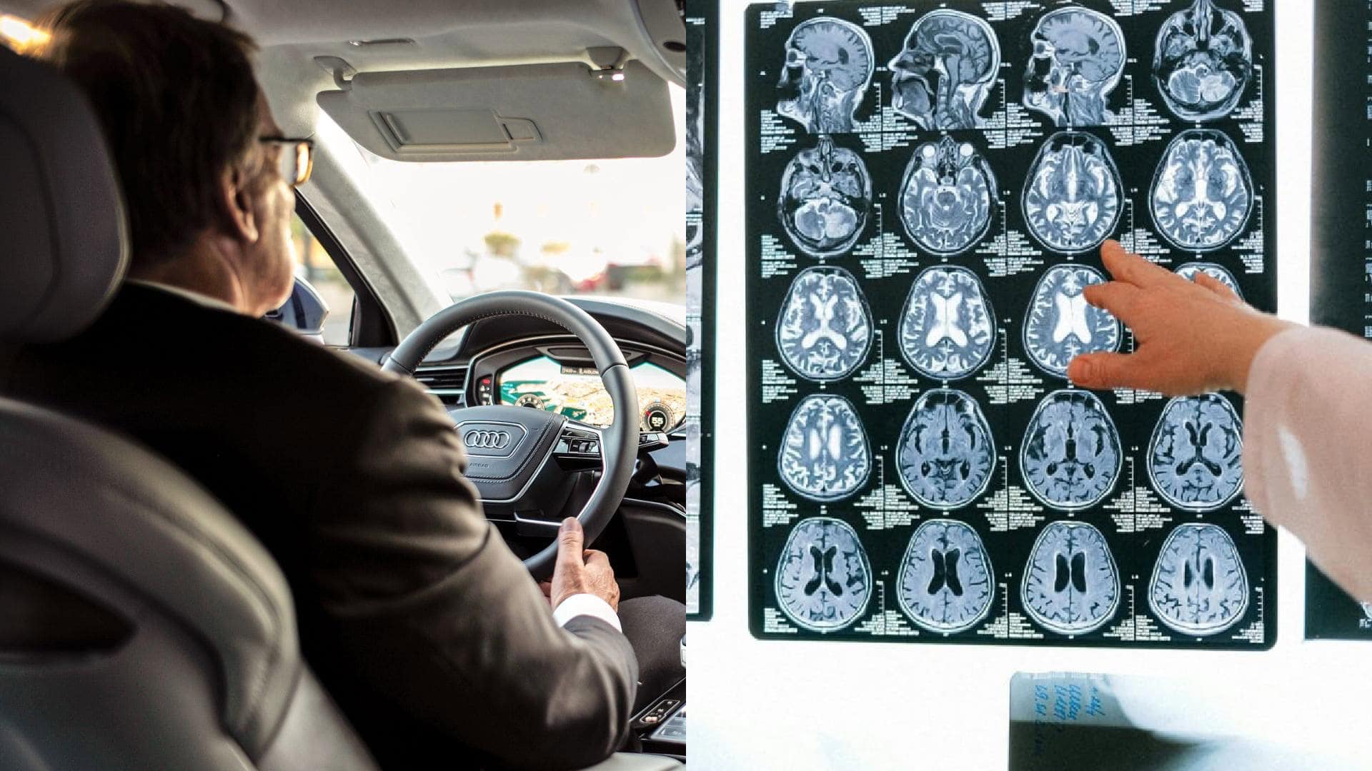 šoférovanie, snímky mozgu