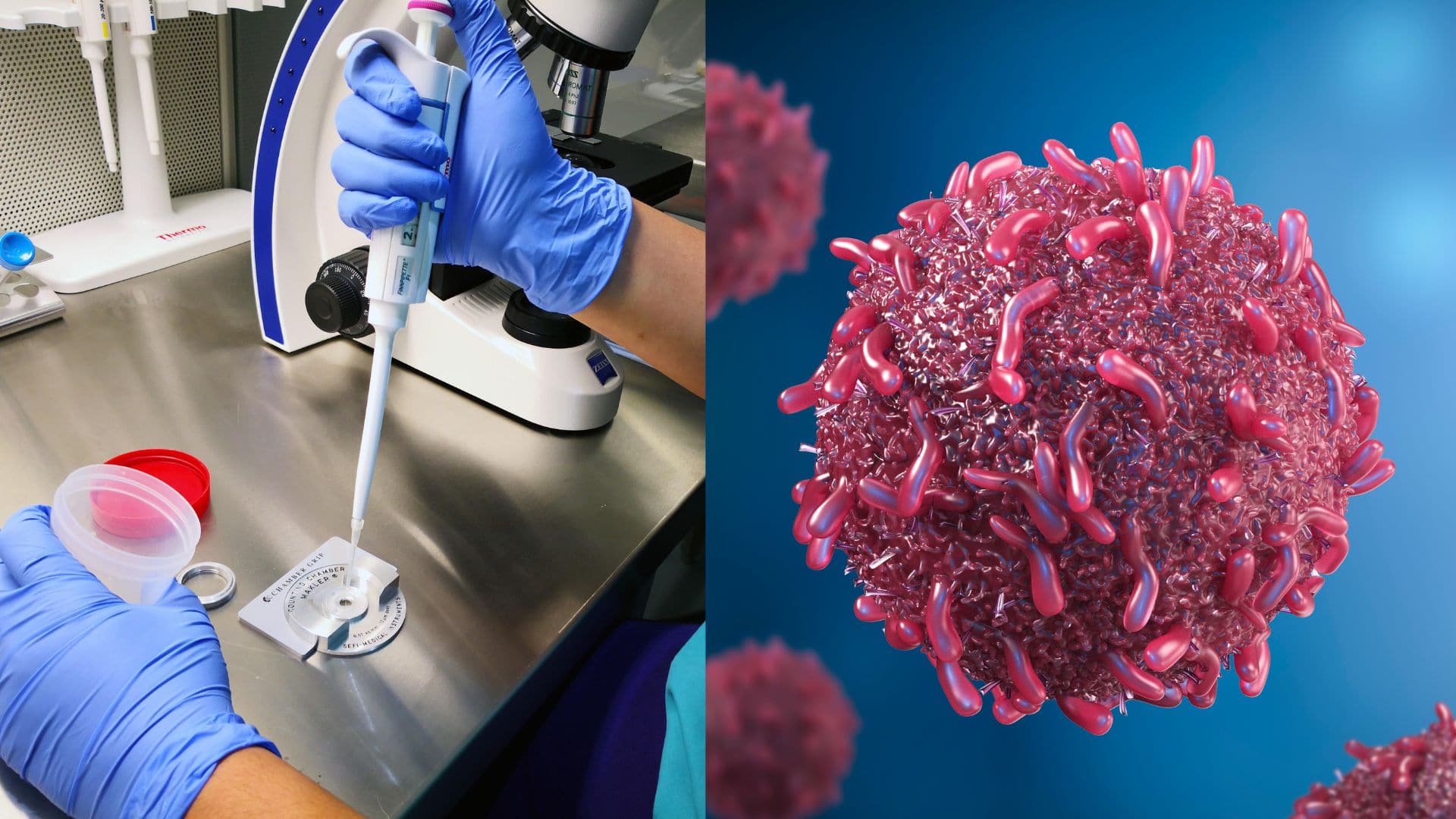 Muž s génom spôsobujúcim rakovinu splodil stovky detí v Európe