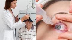 vyšetrenie u očného, suché oči