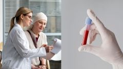 Jednoduchý test môže odhaliť rakovinu pri nenápadných príznakoch. Vedci našli špecifický „proteínový podpis“