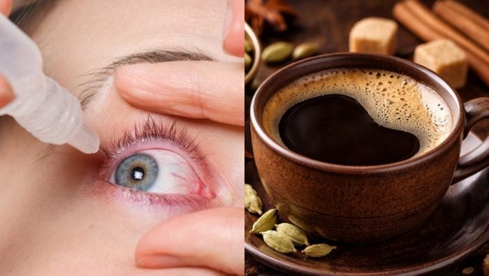 Štvrtina Slovákov ju pije denne. Štúdia spája instantnú kávu s rizikom zákerného ochorenia očí