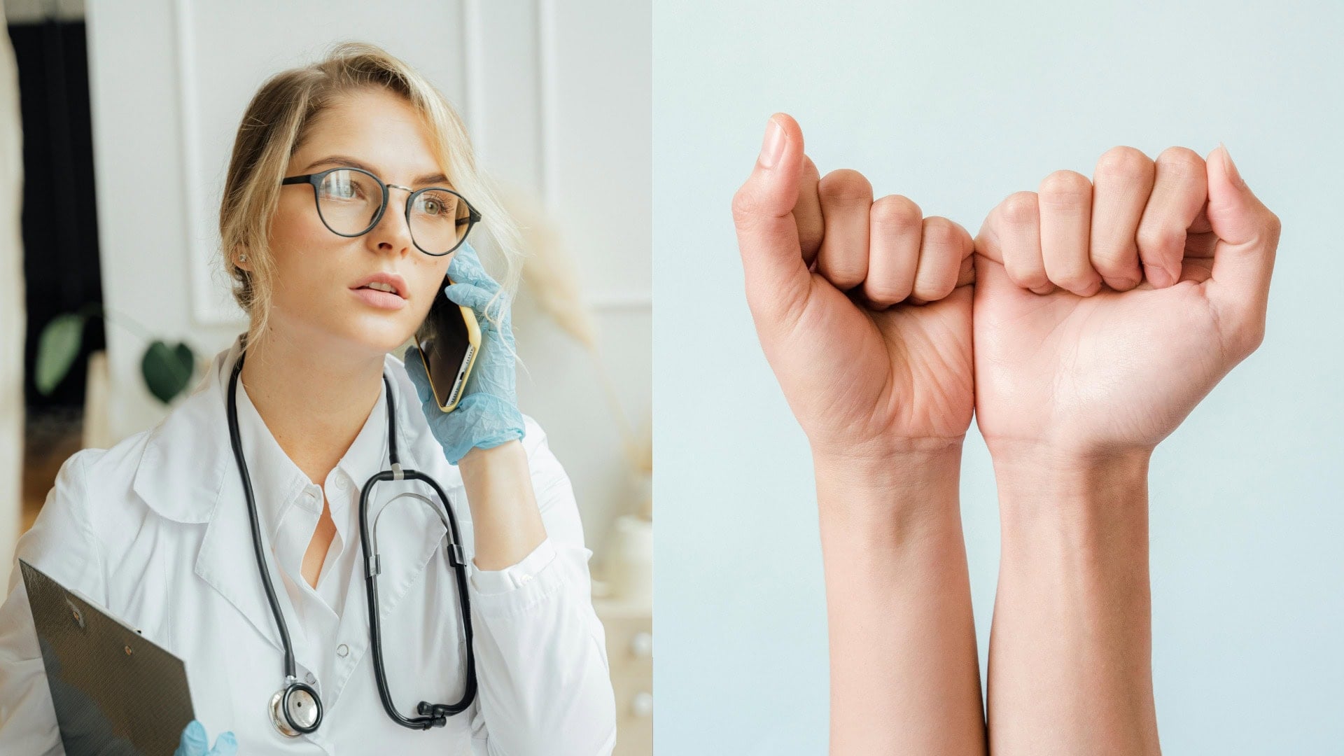 na snimke su lekar, ruky, koza, dlane, doktor