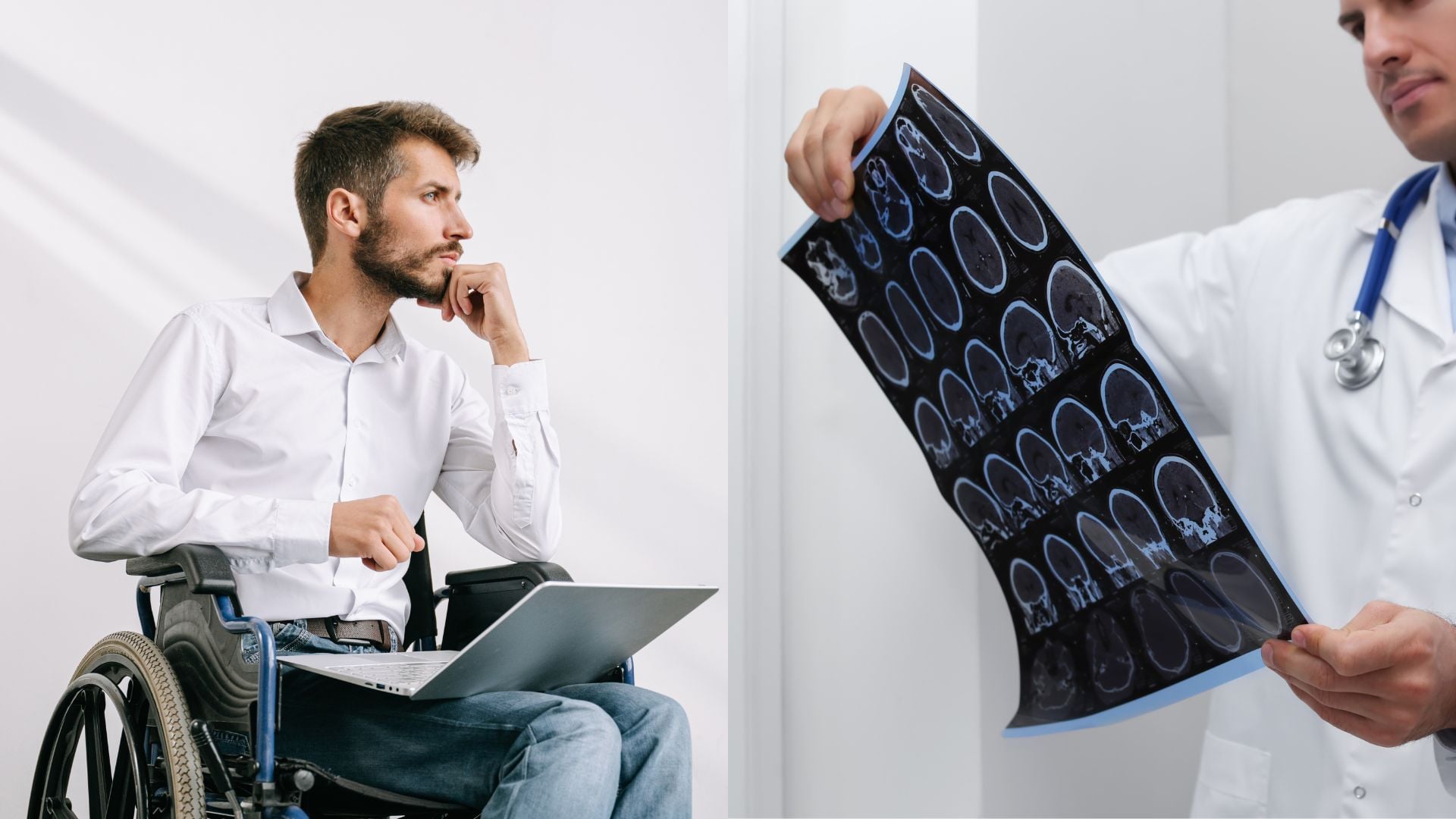 Vedci objavili nový dôkaz: Bežný vírus môže spúšťať sklerózu multiplex