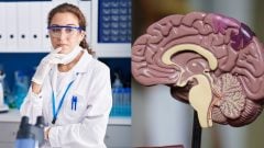 Revolúcia v liečbe najväčšieho zabijaka: Vedci našli novú príčinu vysokého tlaku a spôsob, ako ho „vypnúť“