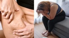 Trpí ňou každá 10. žena, príznaky sú nenápadné: Chirurg varuje pred chorobou, ktorú si mýlime s genetikou