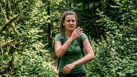 Slovákov desí agresívny hmyz: Po bolestivých štípancoch hlásia opuchy, horúčky aj problémy s pohybom