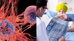 Varovné príznaky v ústach ľudia často ignorujú. Môžu signalizovať rakovinu, onkológovia vyzývajú na ostražitosť