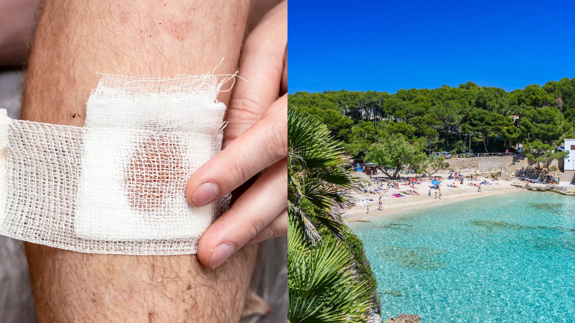 Teplejšie more mení správanie rýb. Na plážach Mallorky pribúdajú prípady štípania